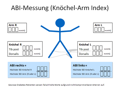 ABI-Messung (Knöchel-Arm-Index)